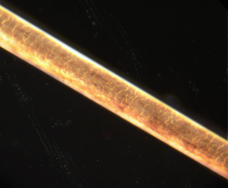 Proteger el folículo piloso y prevenir la caída del cabello en los tratamientos contra el cáncer