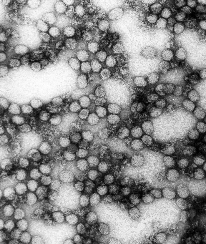 Formas epidemiológicas y modo de transmisión